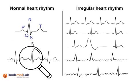 ecg result validity period philippines|ECG Test Price: Cost of ECG in the Philippines .